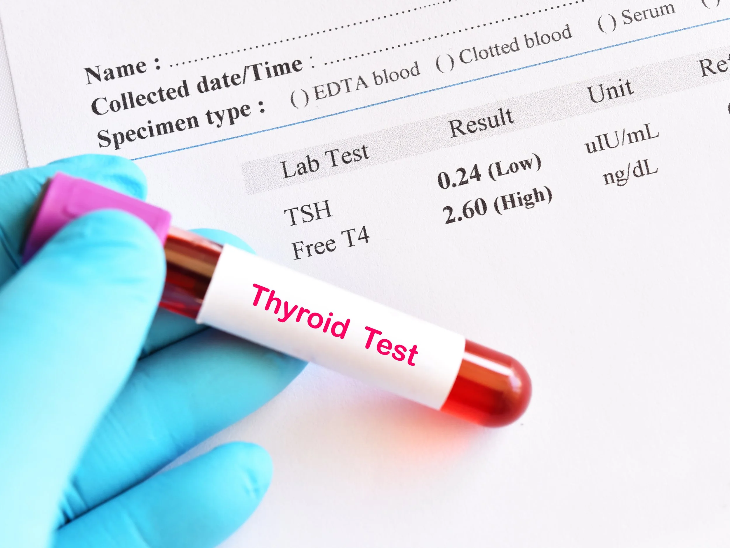 flagged abnormal test result in a patient's medical file.