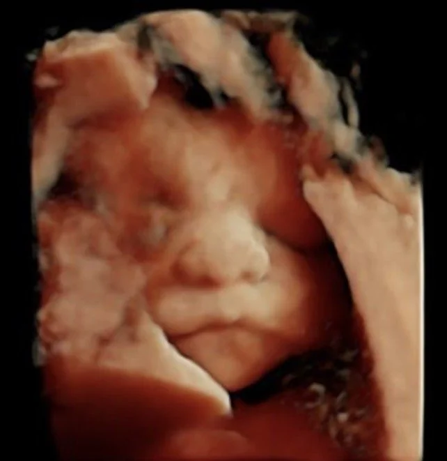 A 3D ultrasound scan of a developing fetus in the womb.