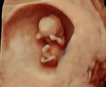 Close-up of a developing fetus inside the womb at an early stage of pregnancy.