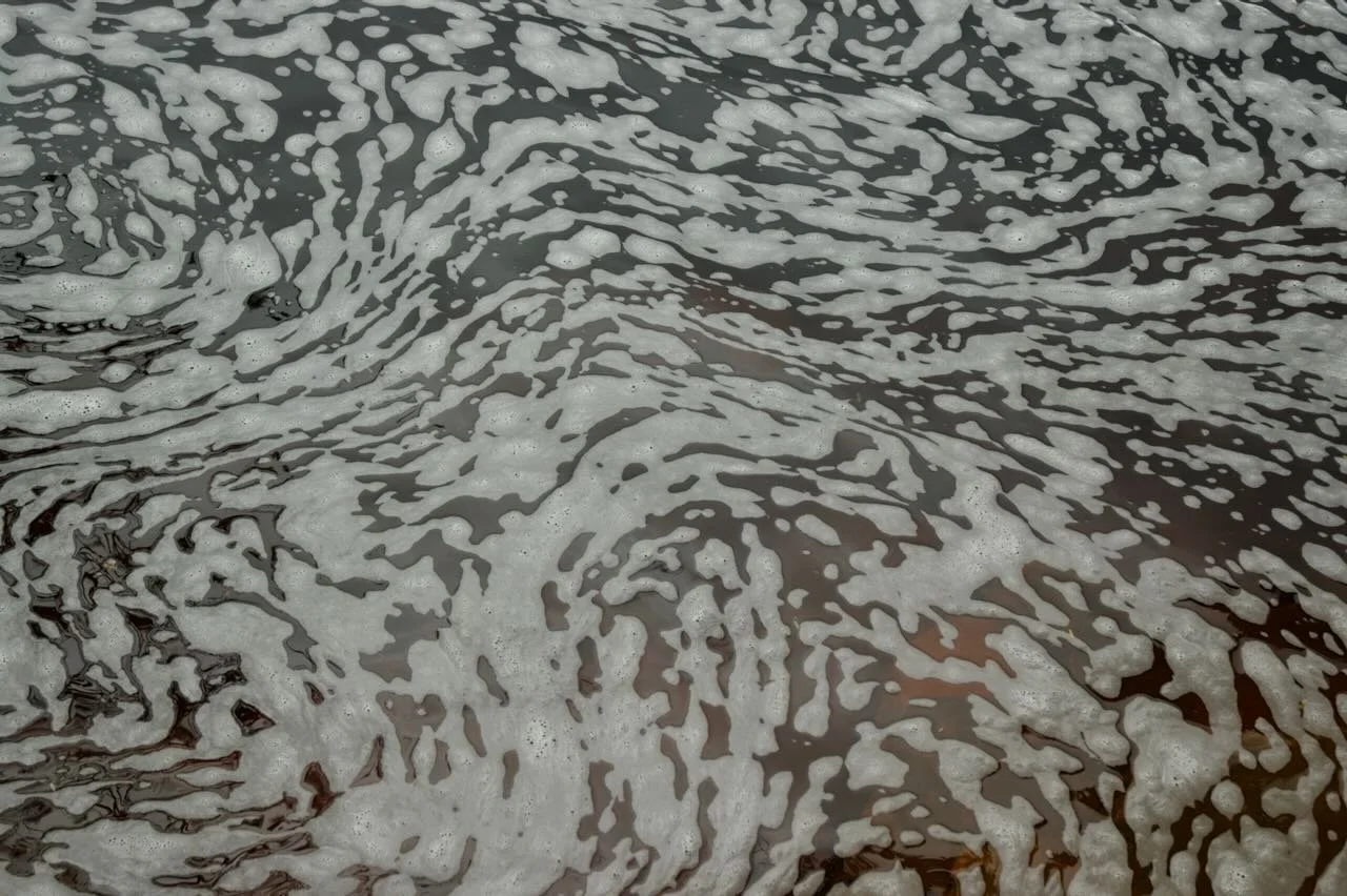 The ANA Test: Medicine’s Most Misinterpreted Marker