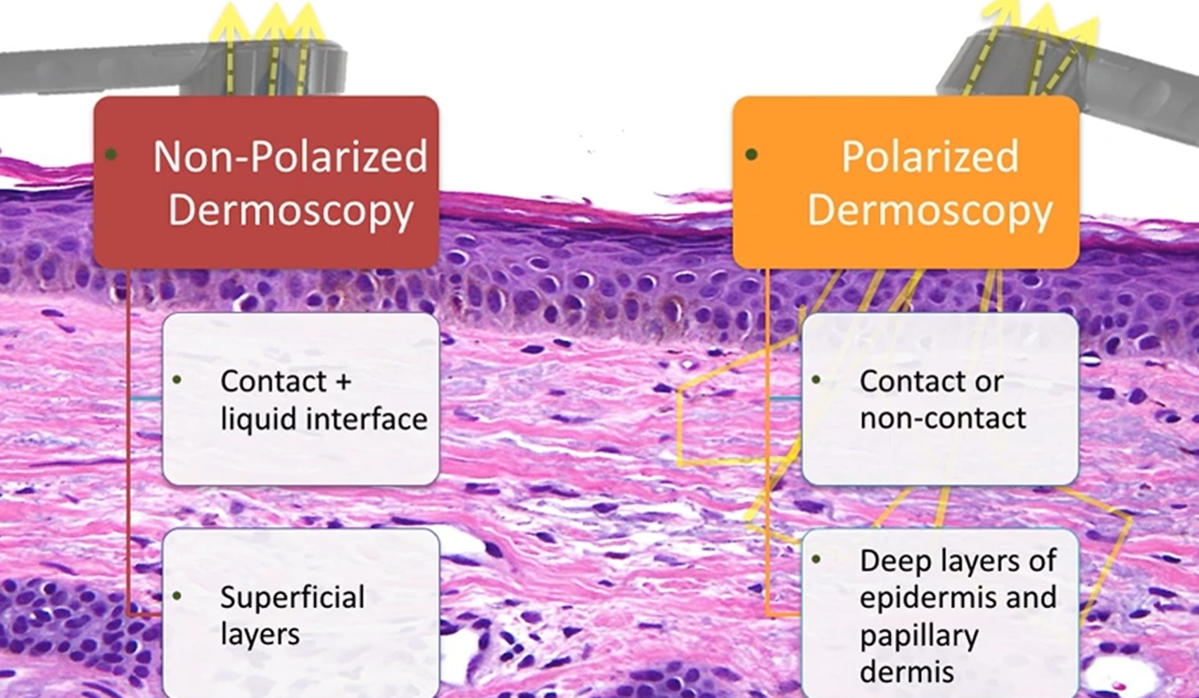 Principles of Dermoscopy
