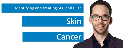Treating Non-Melanoma Skin Cancer