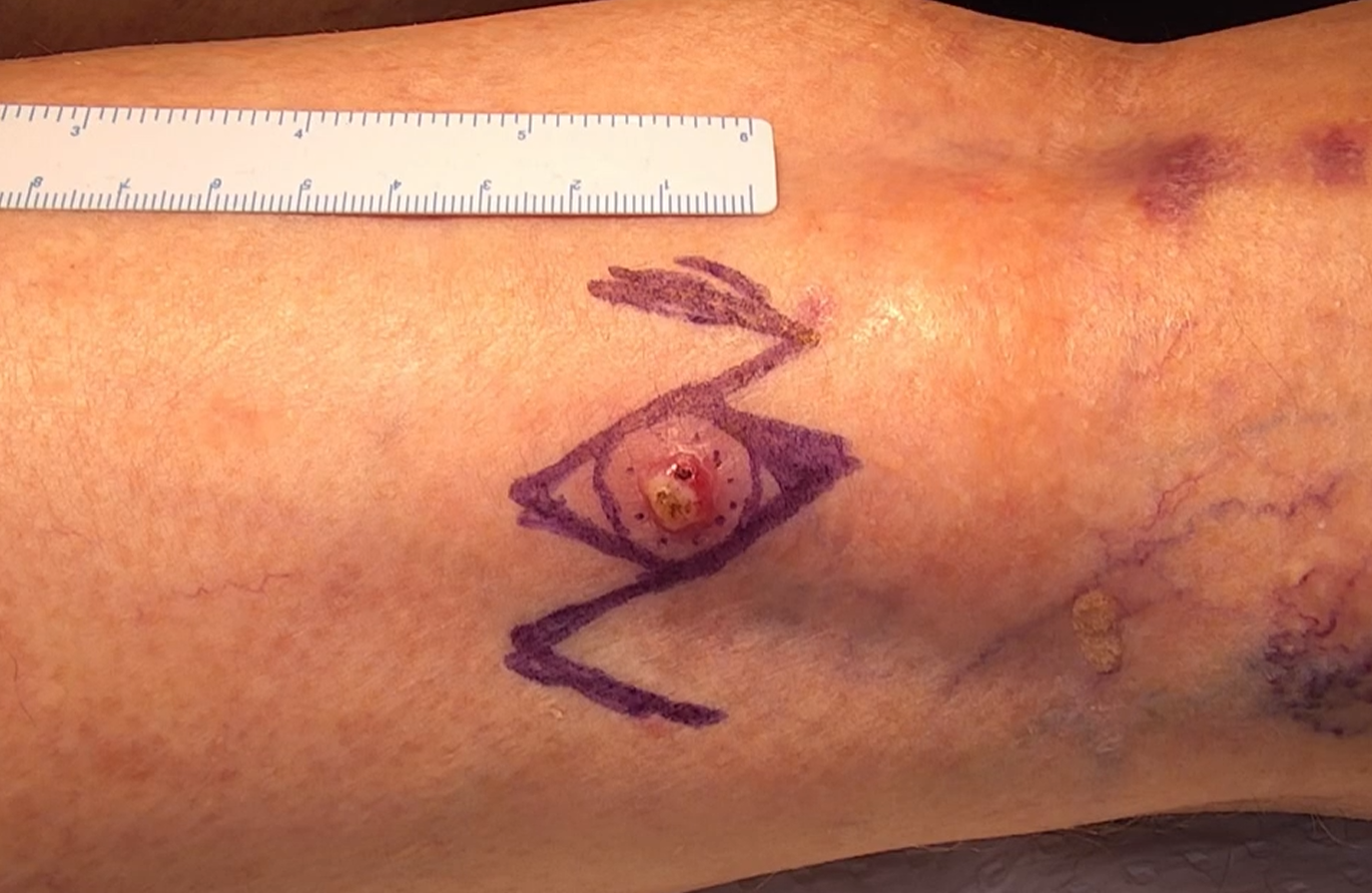 Close-up of skin with a tattoo of a cute, stylized fish inside a diamond shape, with a ruler above for scale.