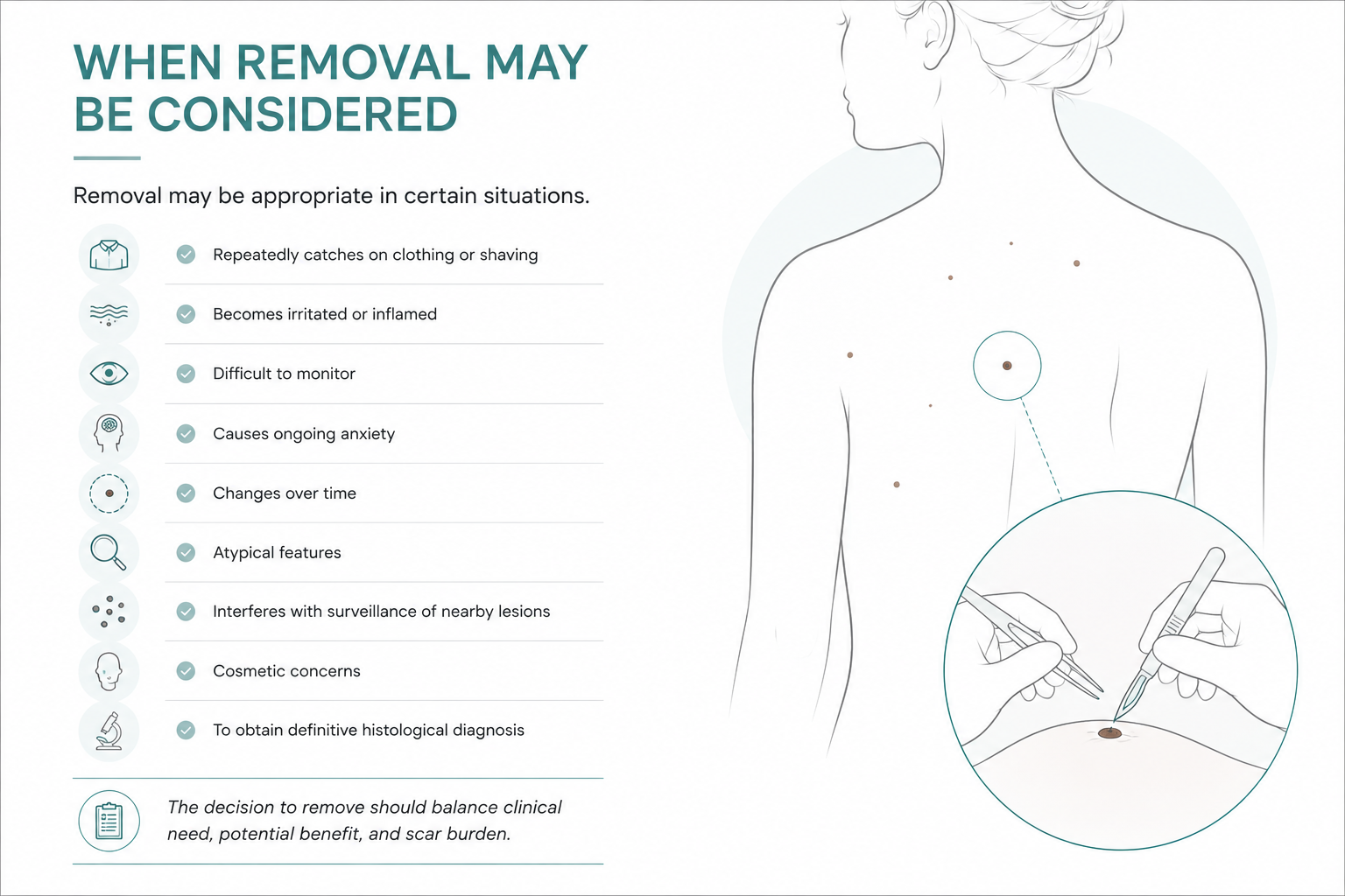 When to consider removal