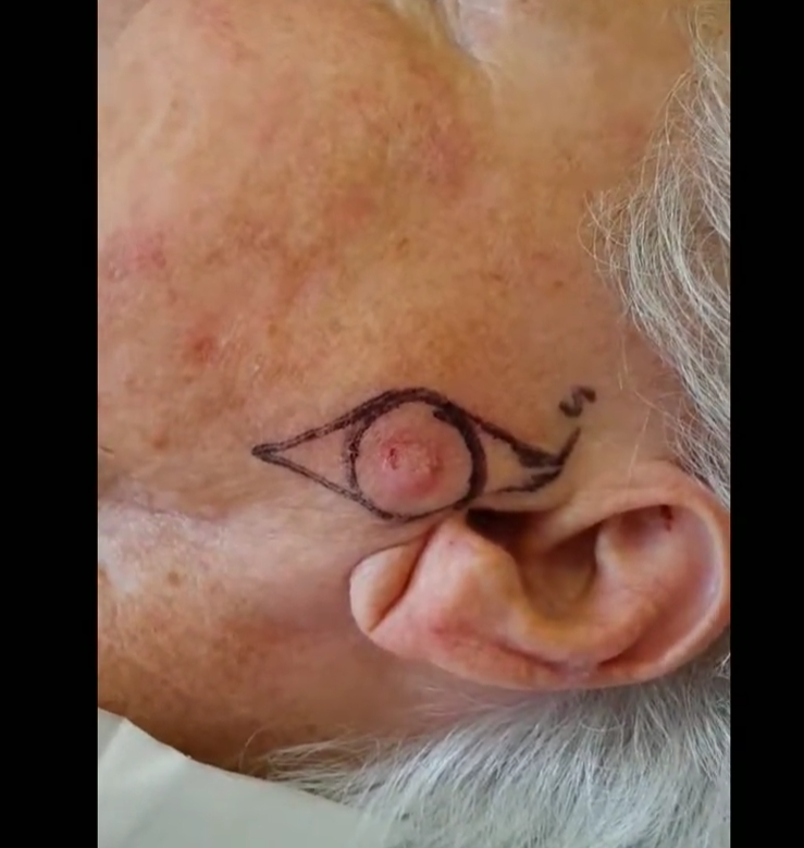 Close-up of a person's face showing a drawing of an eye with a circle in the middle, resembling a third eye, drawn on the temple near the forehead.