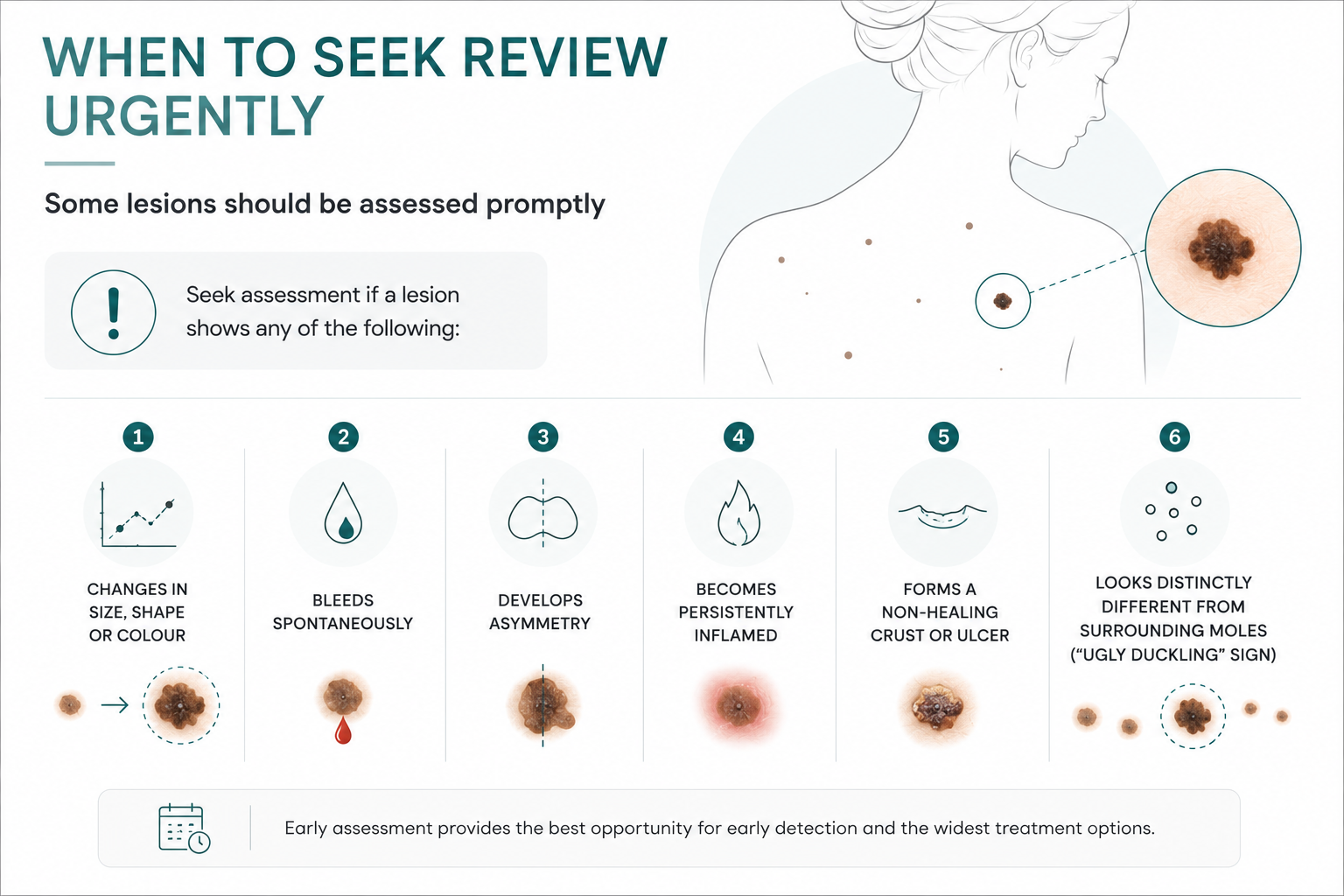 When to seek review