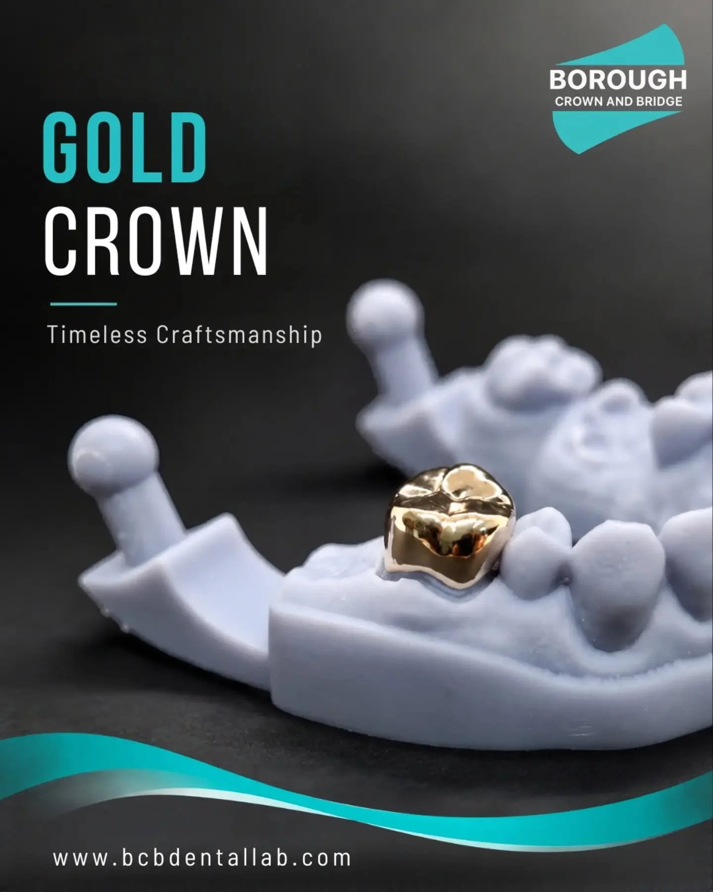 Some restorations never go out of style. ✨

A beautifully finished gold crown, combining traditional restorative solutions with modern dental technology.

At BCB, we offer a wide range of restorative options to suit different clinical needs.

📩 Get 