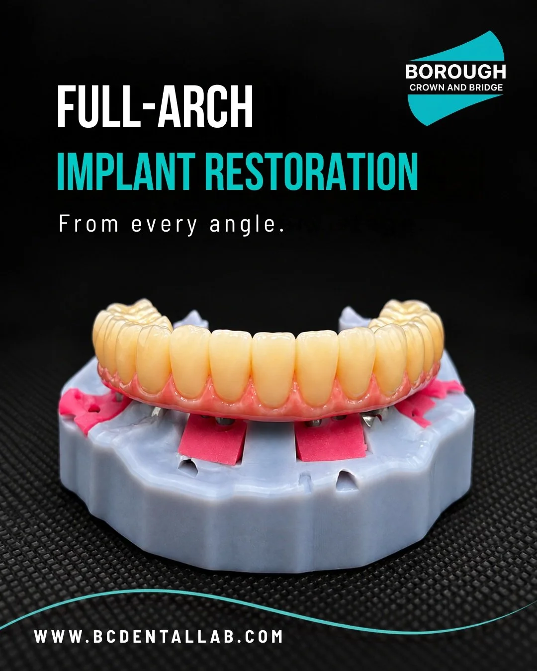 Full-arch implant restoration &mdash; a closer look.

From the finished restoration to the framework beneath it, every stage of a full-arch case requires careful planning, precision and attention to detail.

Swipe through to see this case from differ