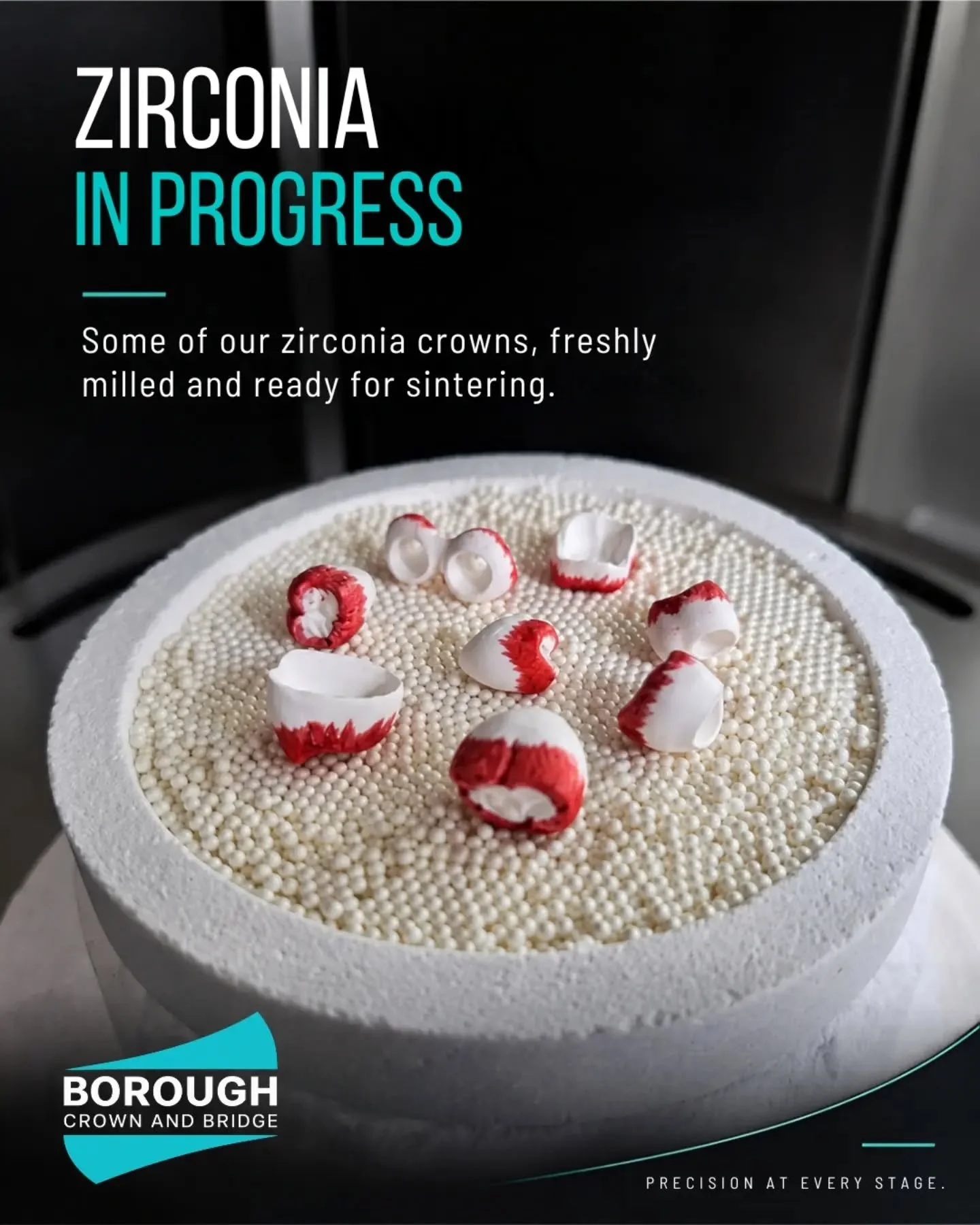 From milling to sintering. ⚙️ &nbsp;

Freshly milled zirconia restorations, prepared and ready for sintering. &nbsp;

A behind-the-scenes look at one of the stages involved in transforming zirconia into the final restoration. &nbsp;
Precision at ever