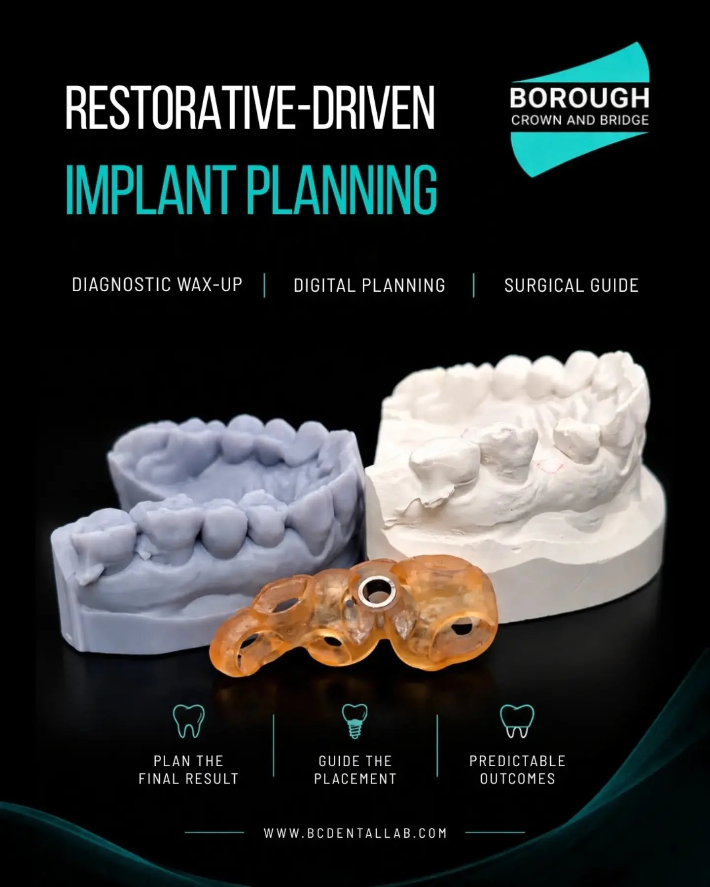 Start with the final restoration in mind. 🦷

Restorative-driven implant planning begins with understanding where the final tooth needs to be.

A diagnostic wax-up helps establish the desired tooth position, which can then guide digital implant plann