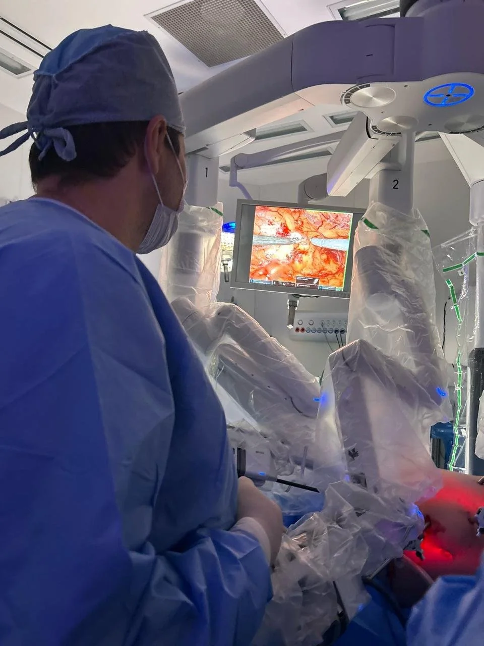 Dr. Giovanni Demartini, cirurgião urologista, operando com tecnologia robótica e monitores na sala de cirurgia.