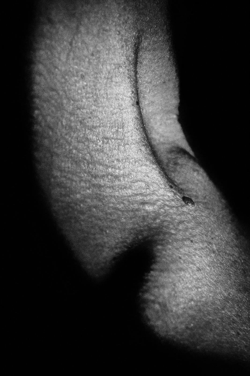 Black and white close-up of a curved body contour with a dark mole beside a long crease, framed by shadow