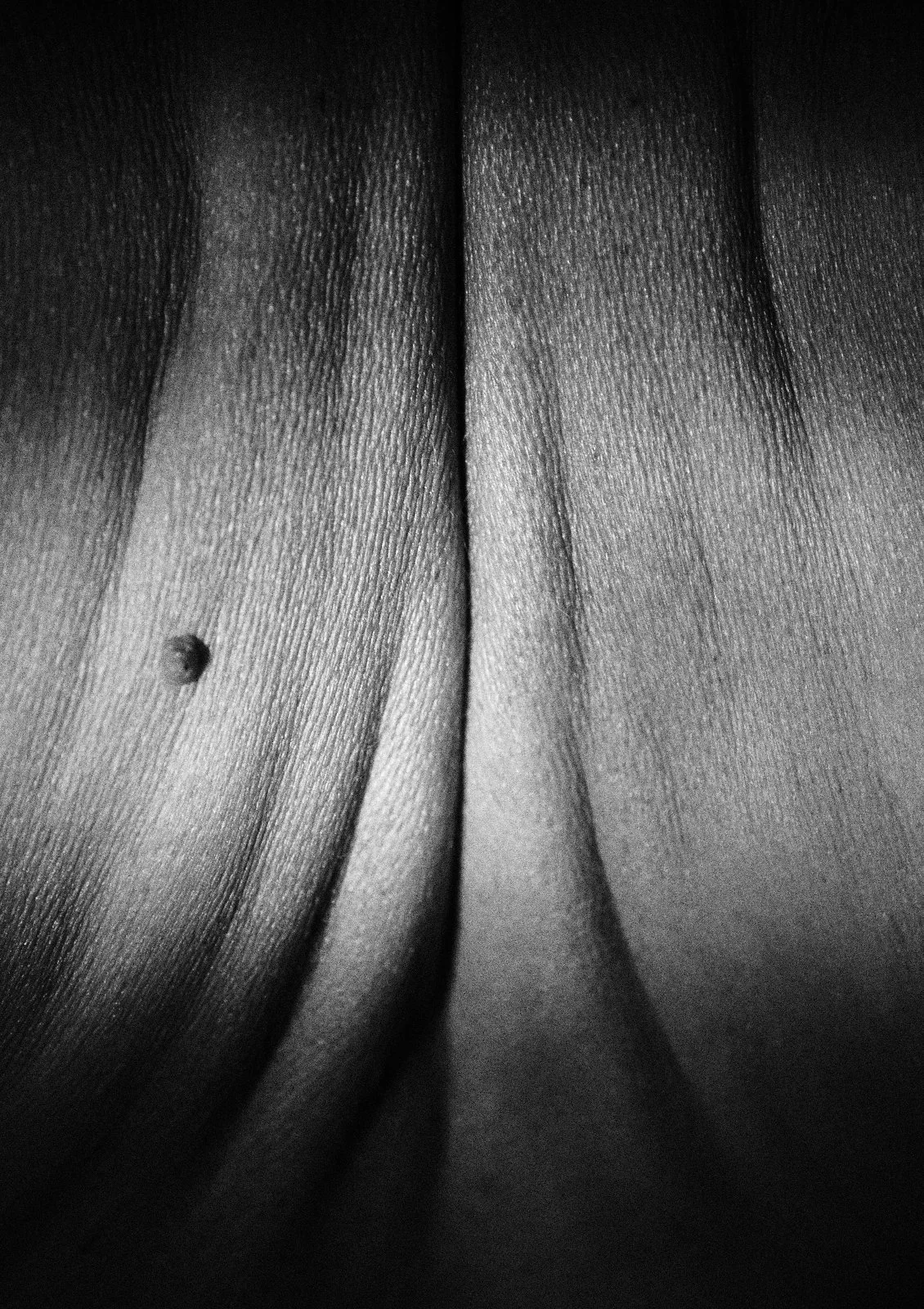 Black and white close-up of skin with a central vertical crease and a single mole, resembling a road running through terrain