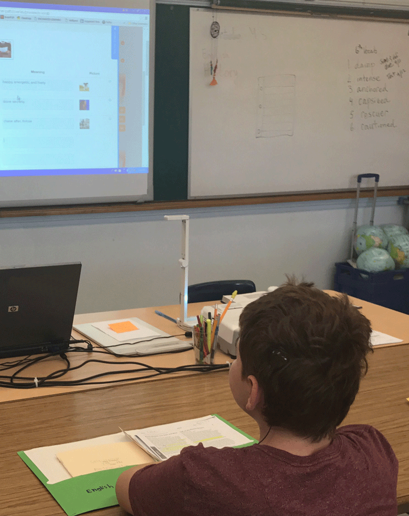 student cochlear implant