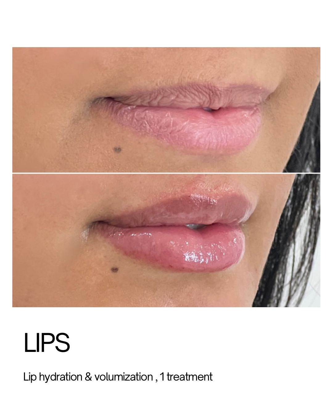 Copy of Minimalist Skincare Beauty Product Promotion Instagram Post (Instagram Post (45)) - 4.PNG