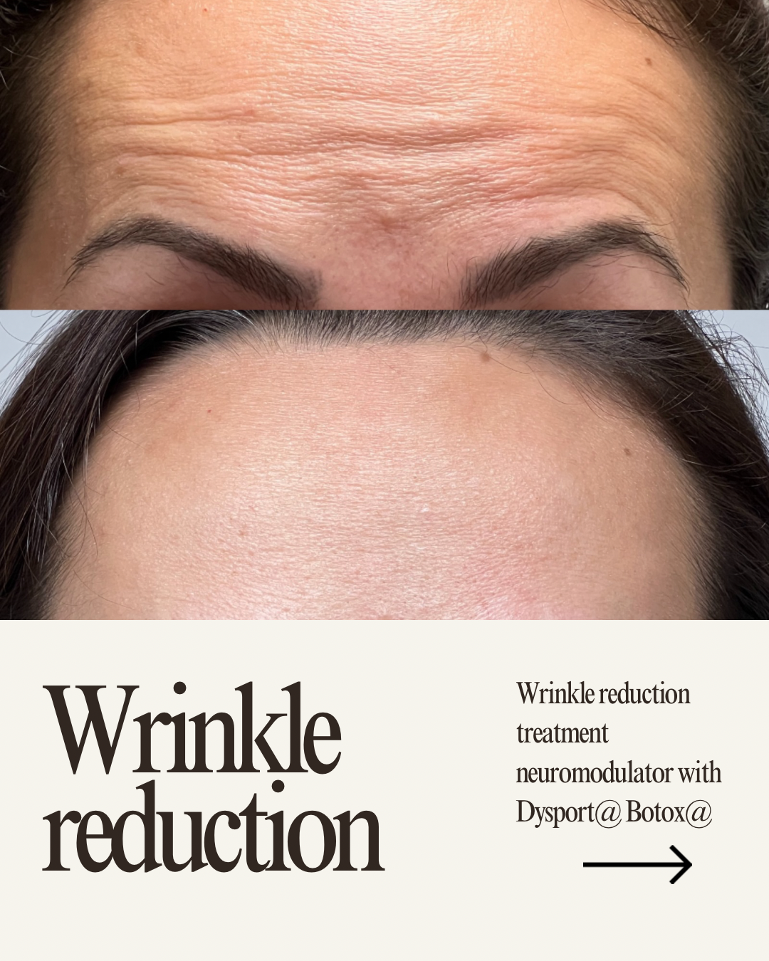 Copy of Copy of Minimalist Skincare Beauty Product Promotion Instagram Post.png