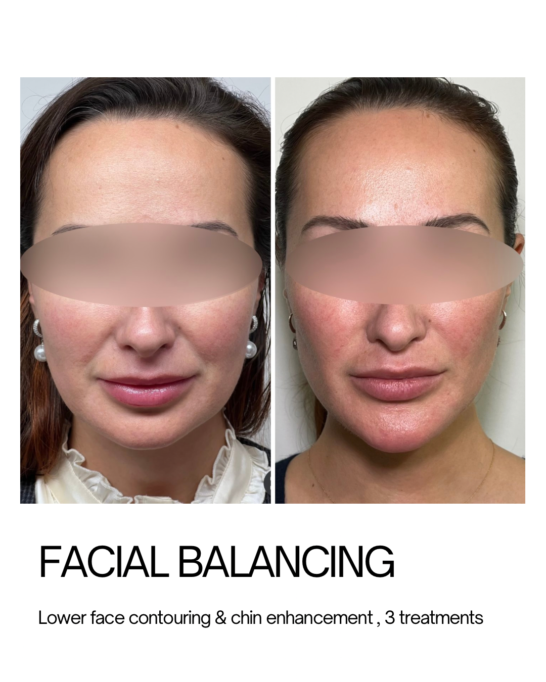 Copy of Minimalist Skincare Beauty Product Promotion Instagram Post (Instagram Post (45)) - 3.PNG