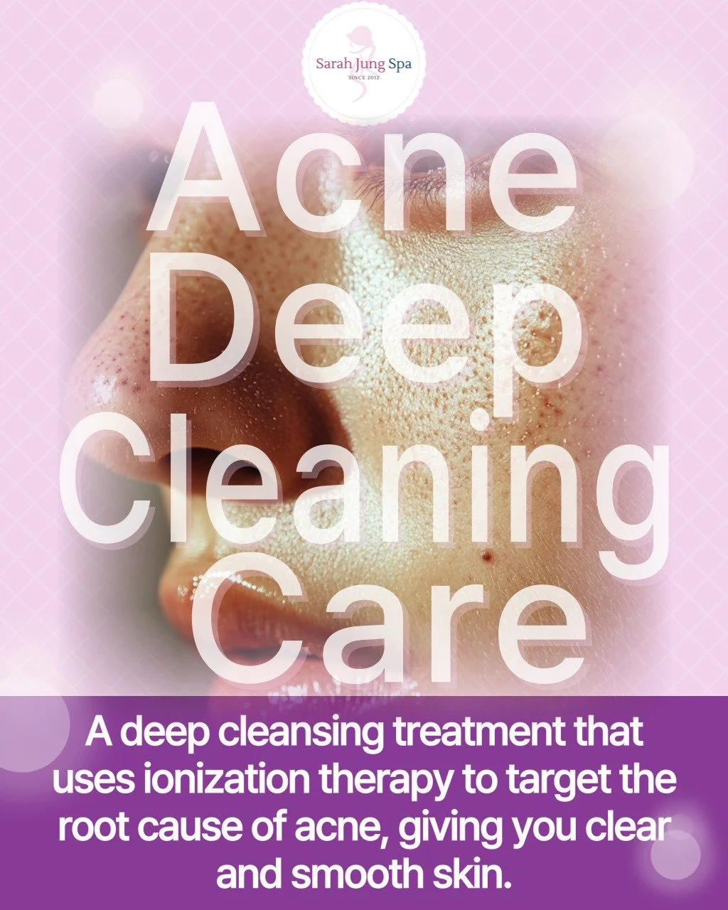 ✨ If you're not loving the skin you're in lately... ✨

It's okay to feel that way. Acne / Deep Cleansing Care is more than just a treatment; it's a special ritual to help you rediscover your confidence and the joy of healthy skin. 💖

With Sarah Jung