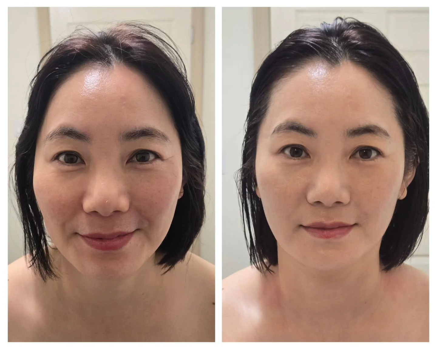 💕After successfully completing the energetic summer camp, the Director of JC After School Leaving Centre visited our spa to recover from sun allergy and overall fatigue.
She received ✨️Facial Super Hydro Lifting Care (Deluxe) and a 1-hour Body Treat