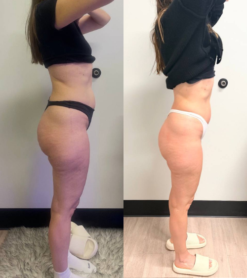 Side-by-side comparison of a woman before and after fitness transformation, showing weight loss and improved muscle tone.