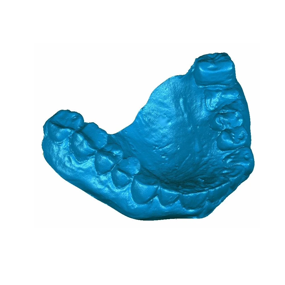 self-serve-scan-sample-teeth-small-3d-scanner.jpg
