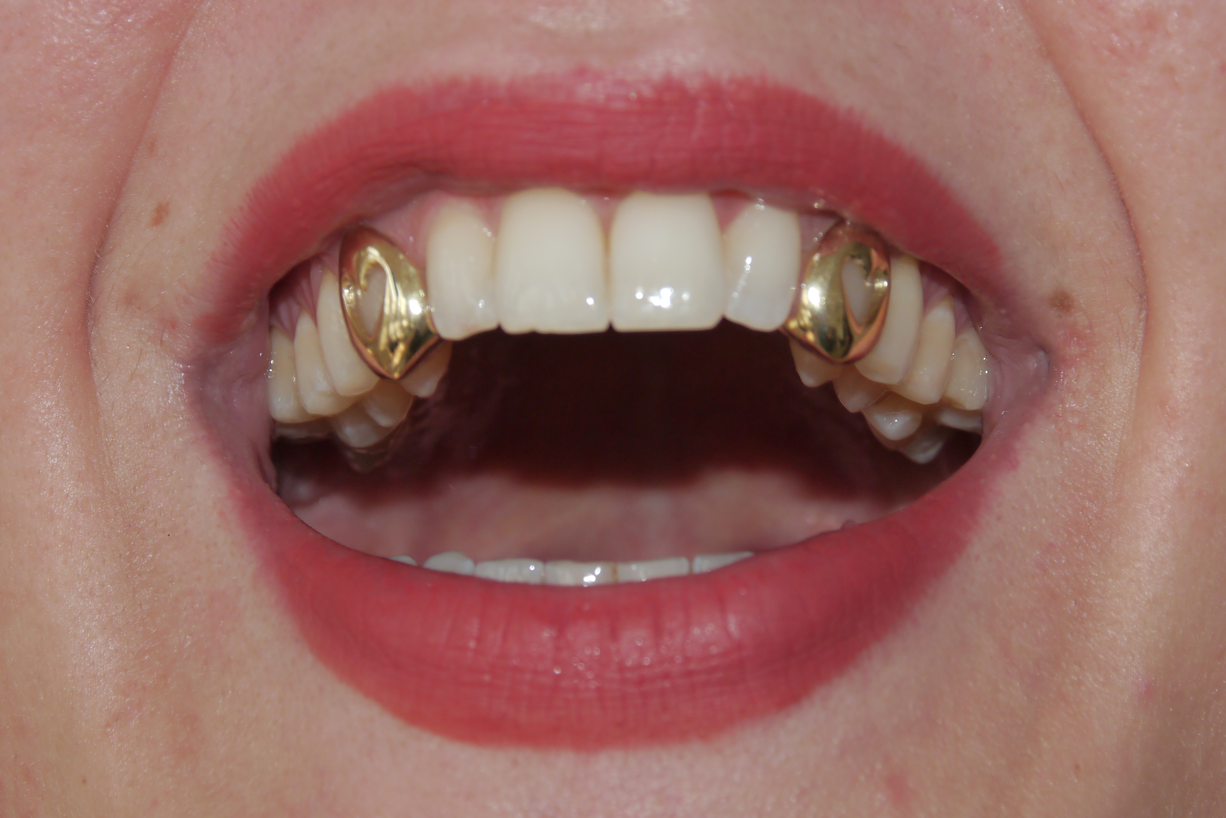 silver jewelley workshop gold grillz custom 