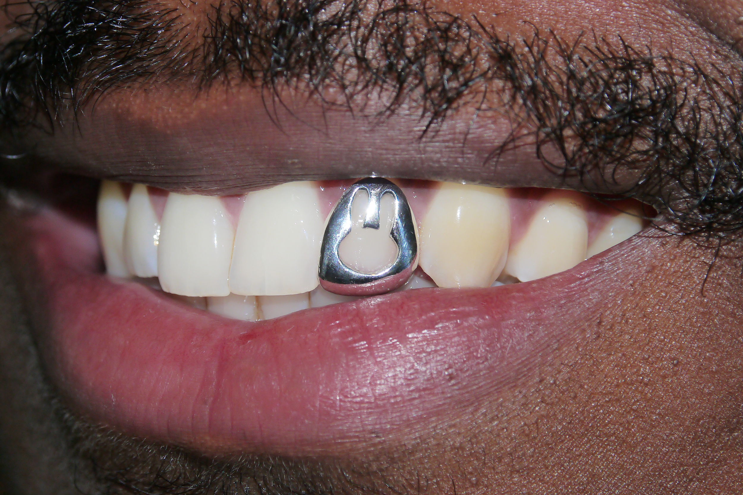 custom grillz Rotterdam 