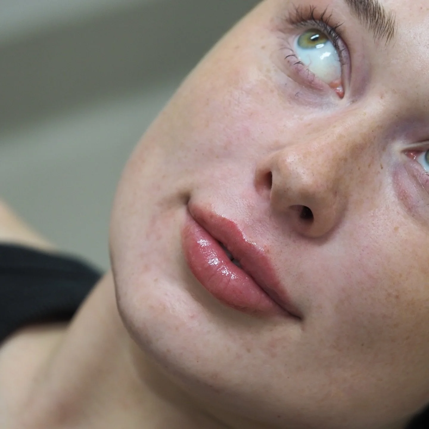 Respecting Natural Lip Anatomy &mdash; The Ruthy Clinic Standard

At The Ruthy Clinic, we believe that beautiful results begin with respecting your natural anatomy. Dr. Ruthy takes the time to carefully assess your facial features, goals, and expecta