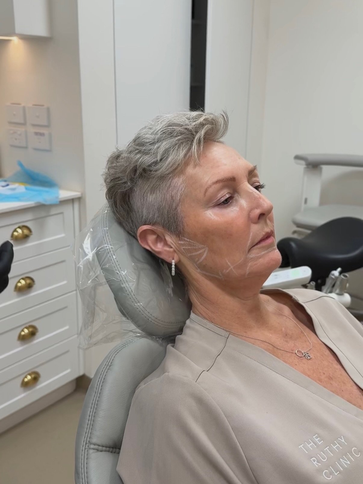 Every smile we care for carries a story, and we never take that trust for granted.

These are our rituals and everyday cases at The Ruthy Clinic, where dentistry, aesthetics, and wellbeing come together in a thoughtful and personalised approach to ca