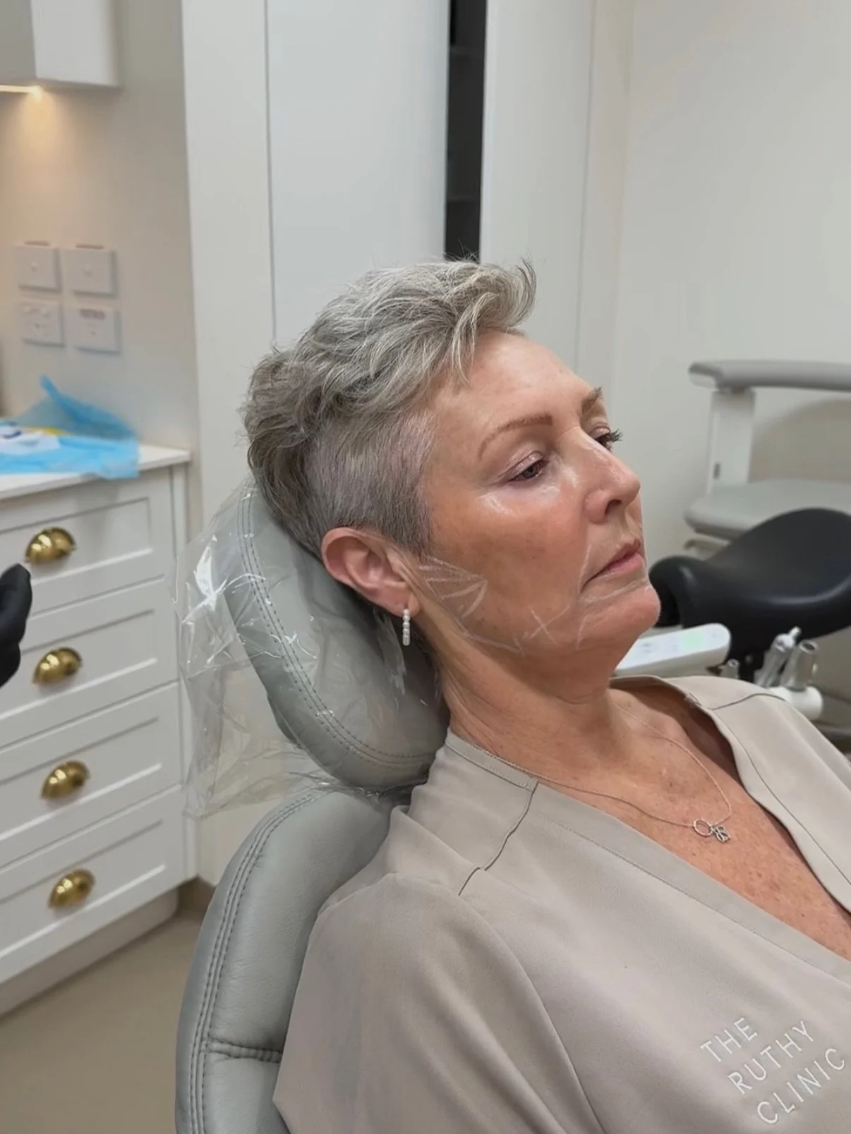 Every smile we care for carries a story, and we never take that trust for granted.

These are our rituals and everyday cases at The Ruthy Clinic, where dentistry, aesthetics, and wellbeing come together in a thoughtful and personalised approach to ca