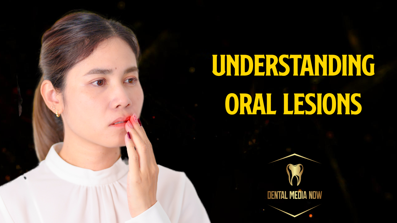 Understanding Oral Lesions: Common Soft and Hard Tissue Changes in the Mouth