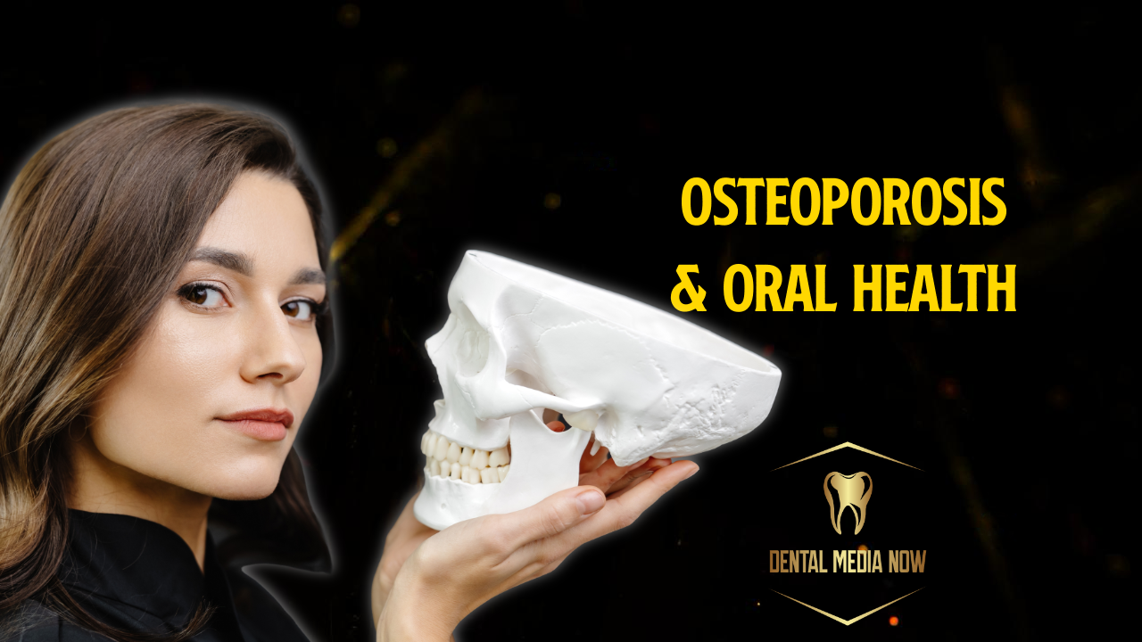 The Link Between Osteoporosis and Oral Health: What You Need to Know