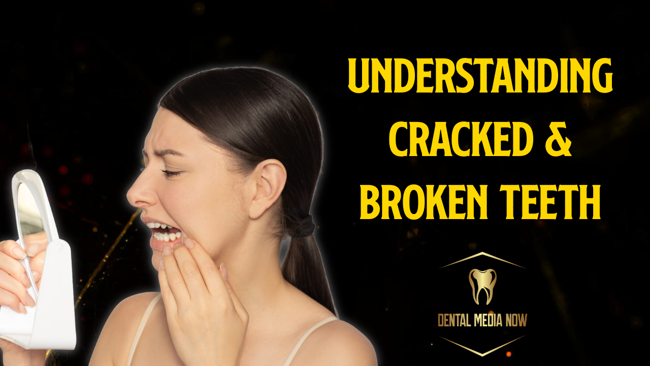 Broken Teeth and Cracked Tooth Syndrome: Warning Signs, Causes, and Prevention