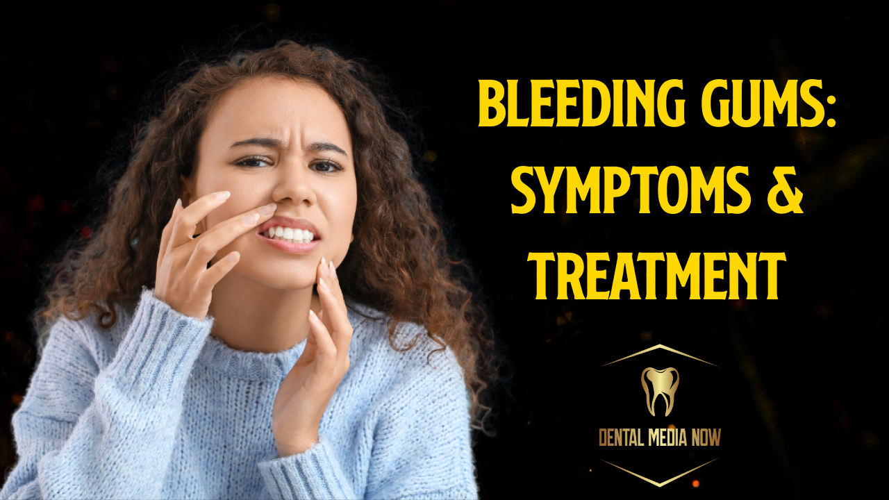 Bleeding Gums: Causes, Symptoms, Treatment, and Prevention