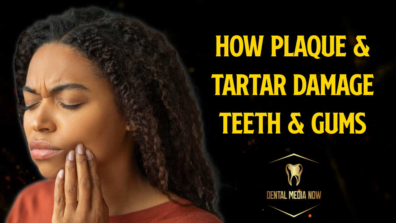 The Effects of Plaque and Tartar on Your Teeth and Gums