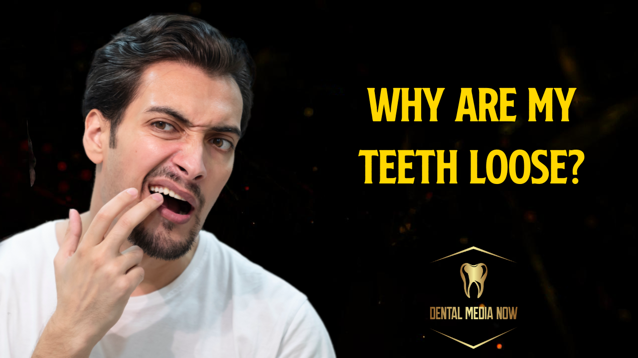 Why Are My Teeth Loose? Common Causes and What You Need to Know