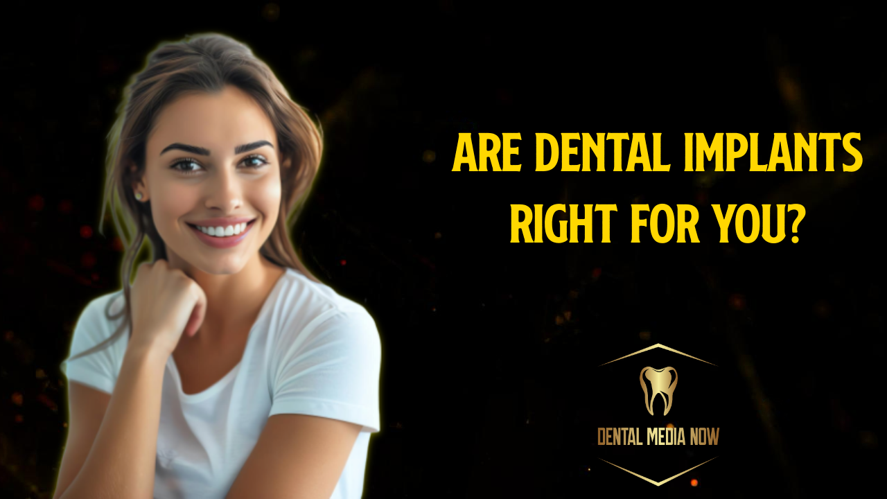 Dental Implants: What Patients Should Know About Their Tooth Replacement Options