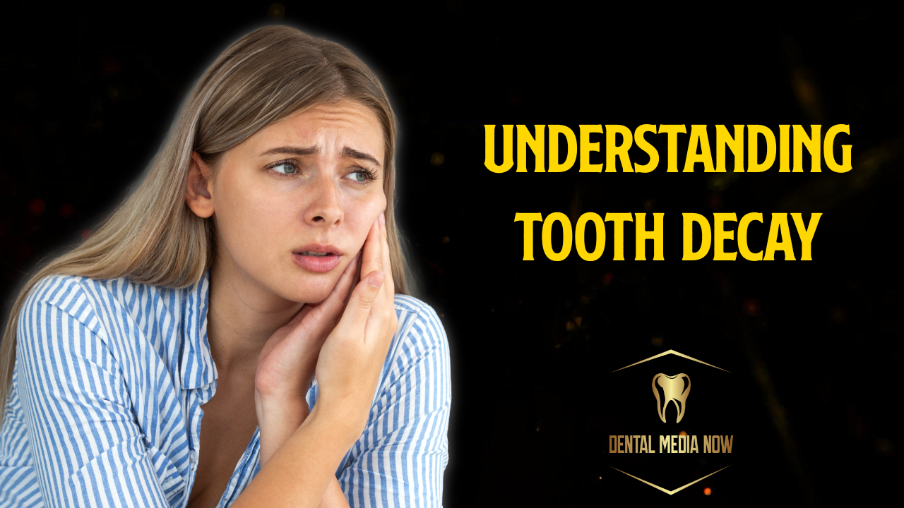 Tooth Decay: Causes, Prevention, Treatment, and Early Warning Signs