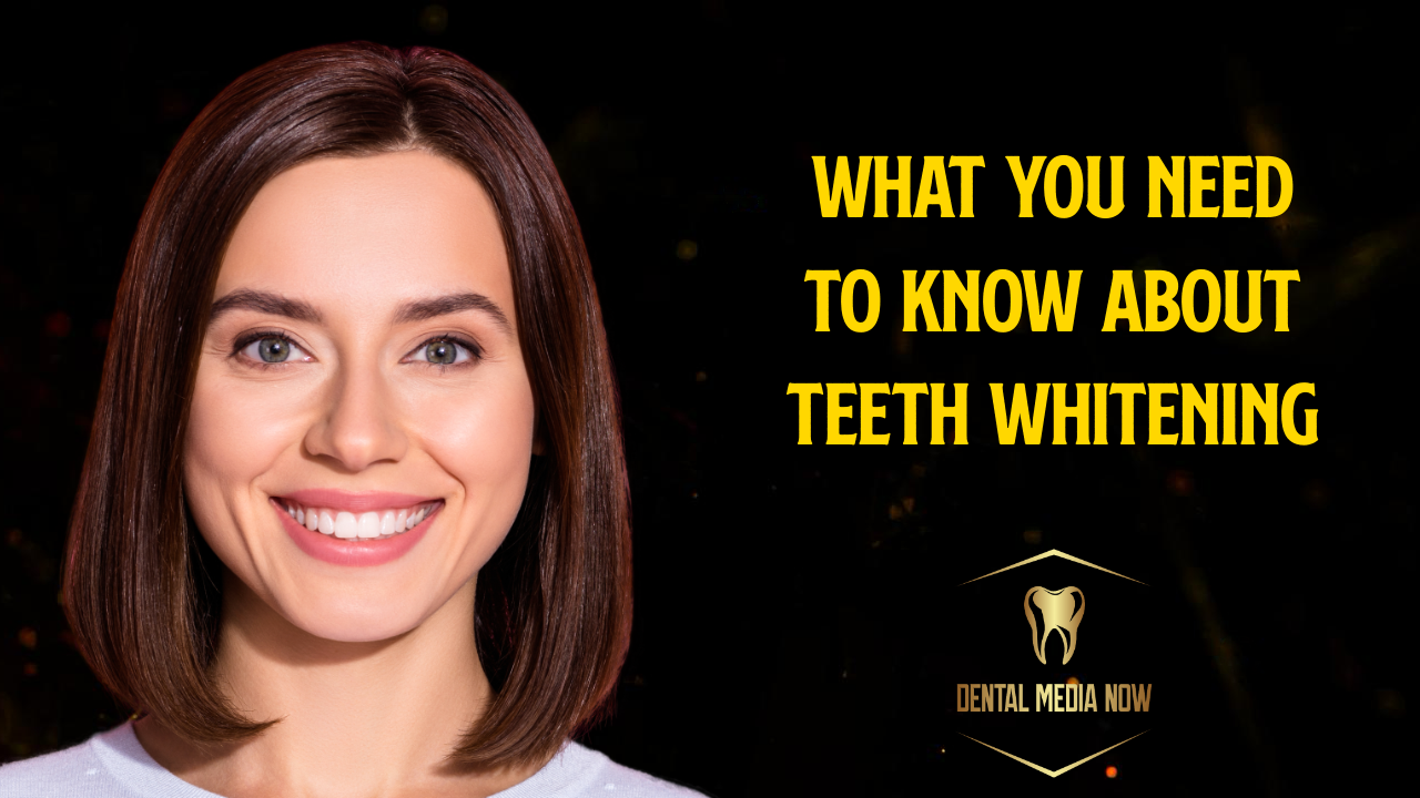 Teeth Whitening: What Patients Should Know About Options, Safety, Results, and Maintenance