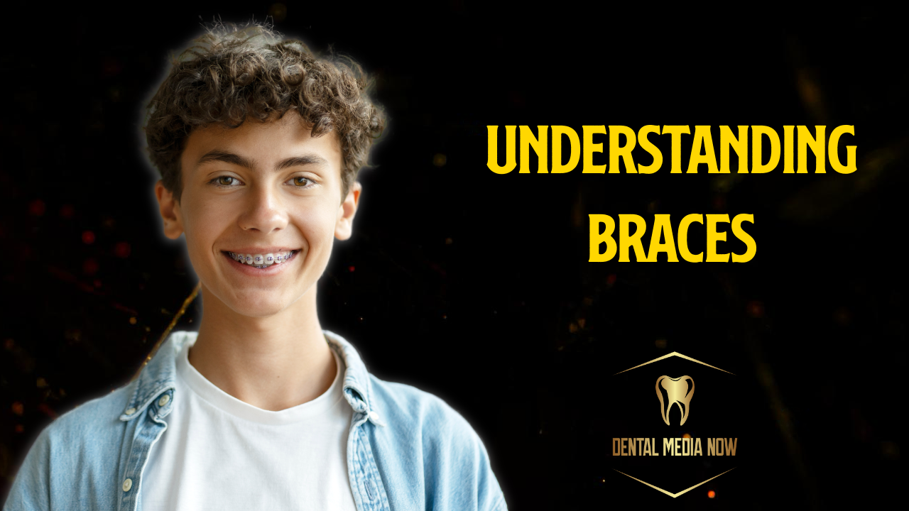 Understanding Braces: How They Straighten Teeth and Improve Oral Health