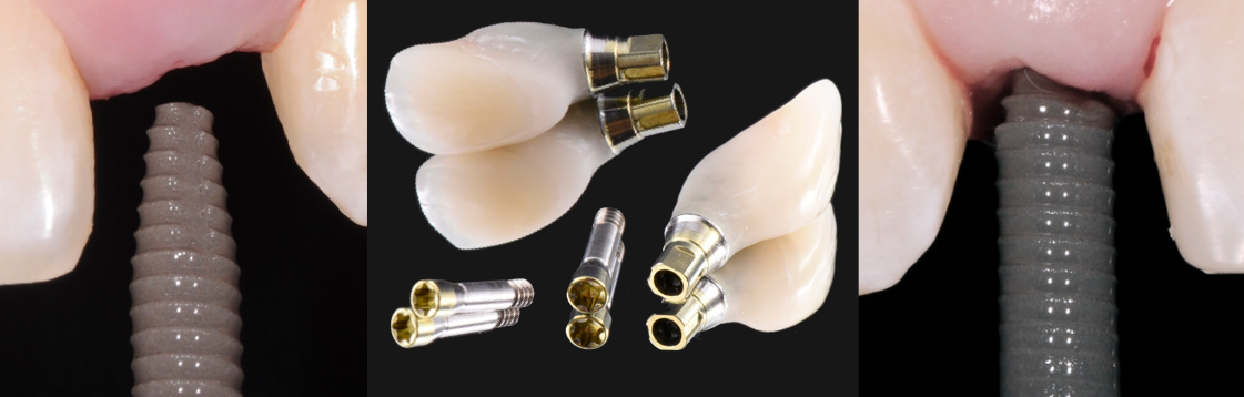 research-patients-bone-grafting