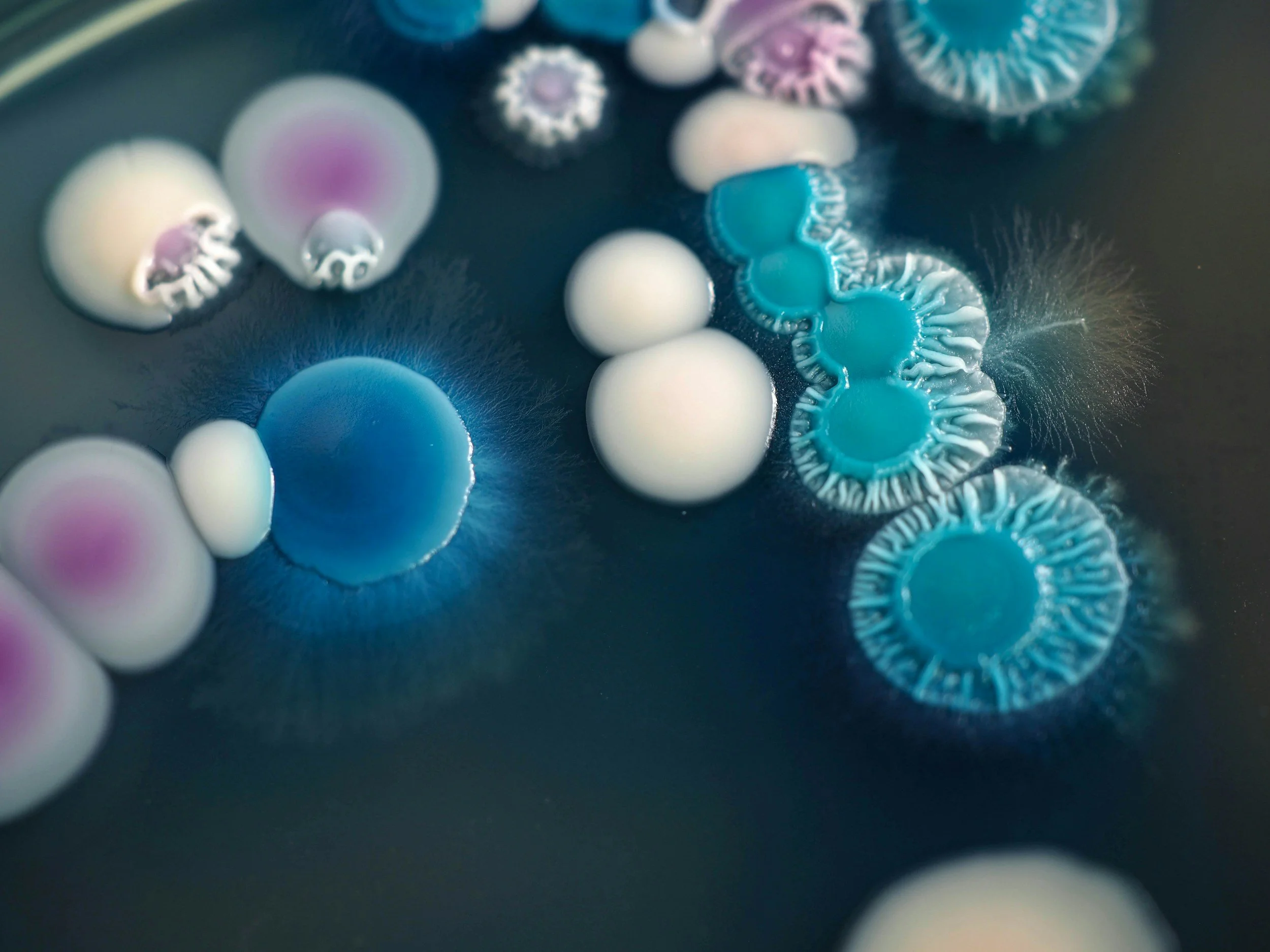 Bacteria visible at the cellular level under a microscope, the kind of magnification made possible only by precision-ground glass lenses
