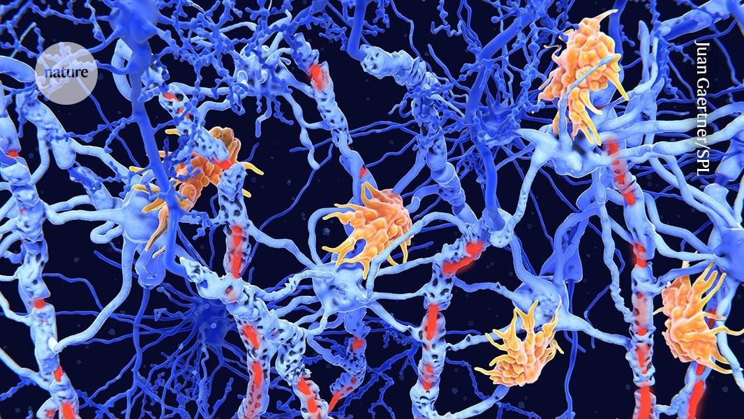 The Road to a Cure: Where MS Research Stands in 2026