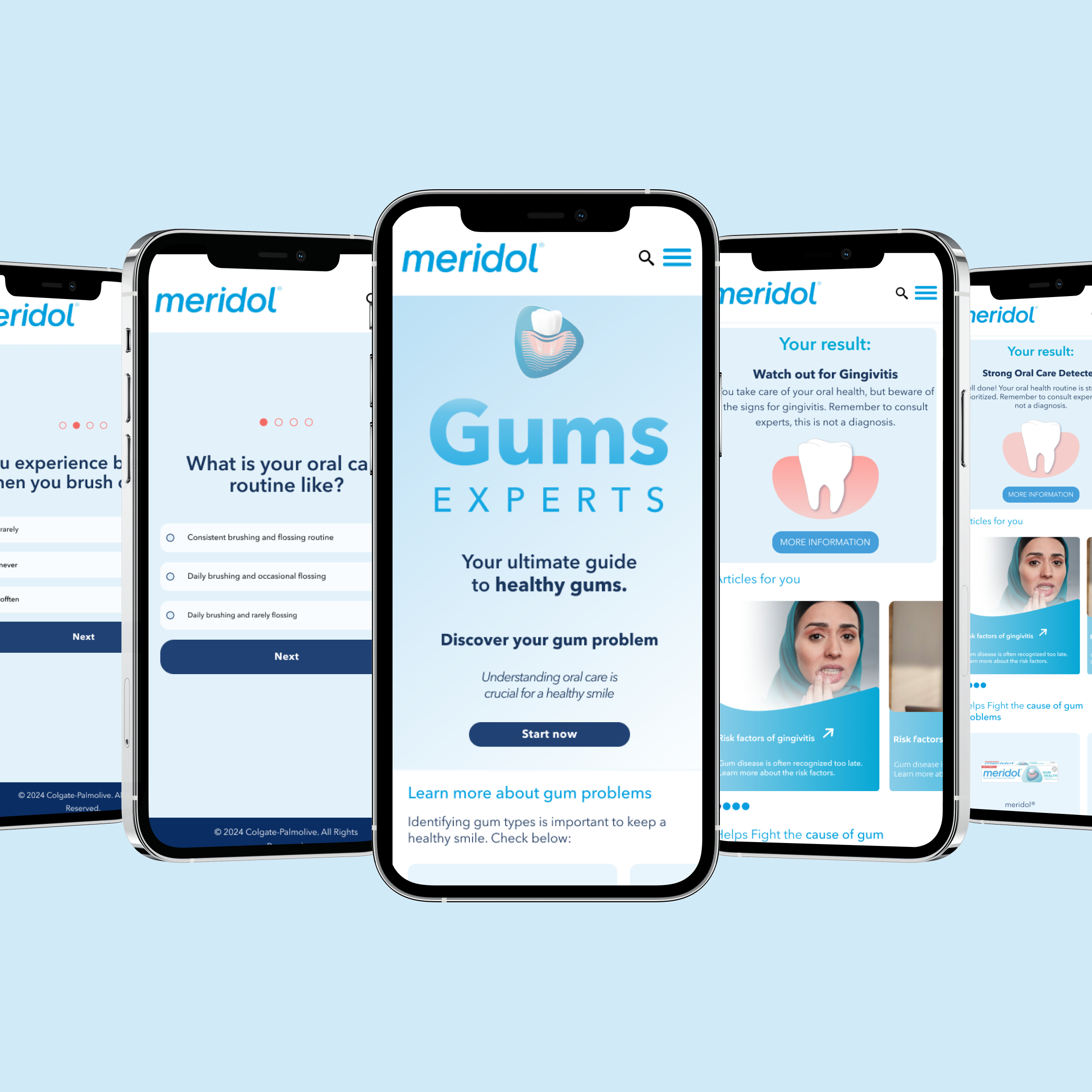 Multiple smartphones displaying the Gums Experts website, which provides information about oral health and gum problems.