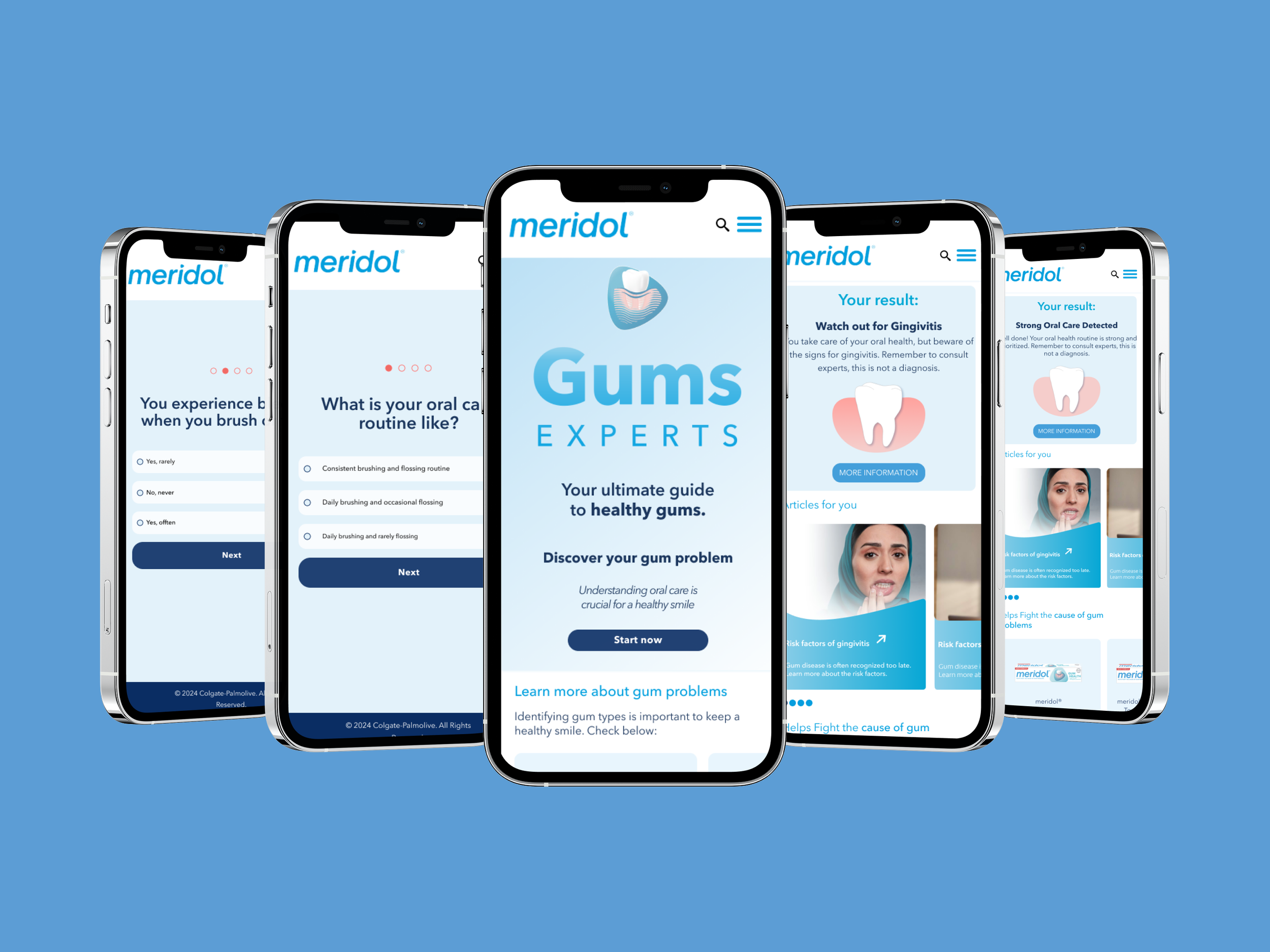 Multiple smartphones displaying the Gums Experts website, which provides information about oral health and gum problems.