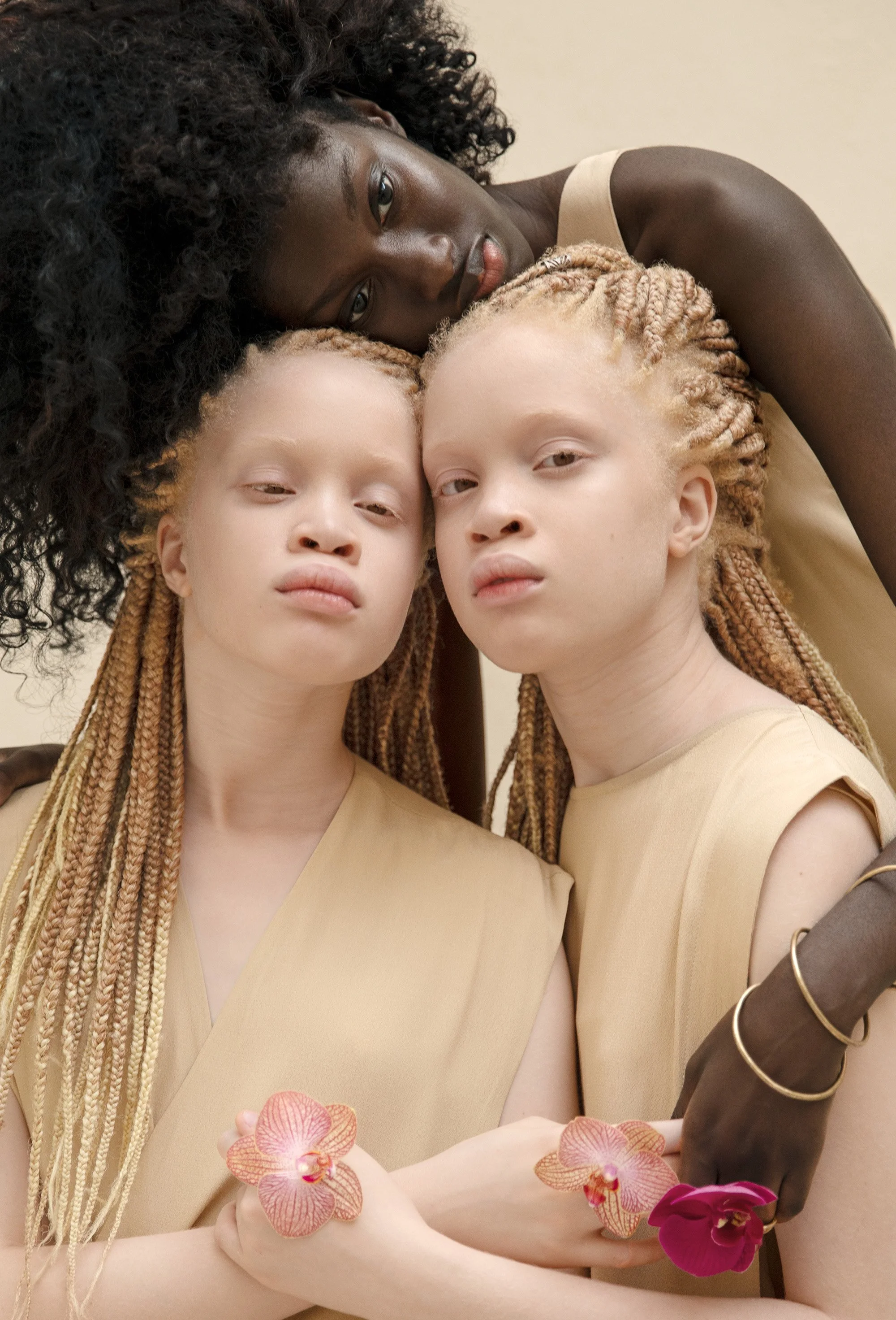 Brazil - Twins with Albinism35_web.jpg