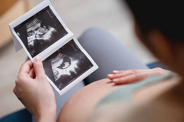 📉 Failure to Monitor Fetal Growth or Development: Legal Consequences and Case Support