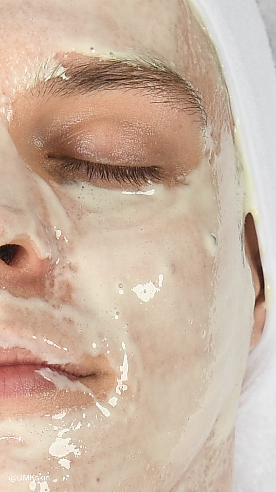 Why Barrier Repair Matters 