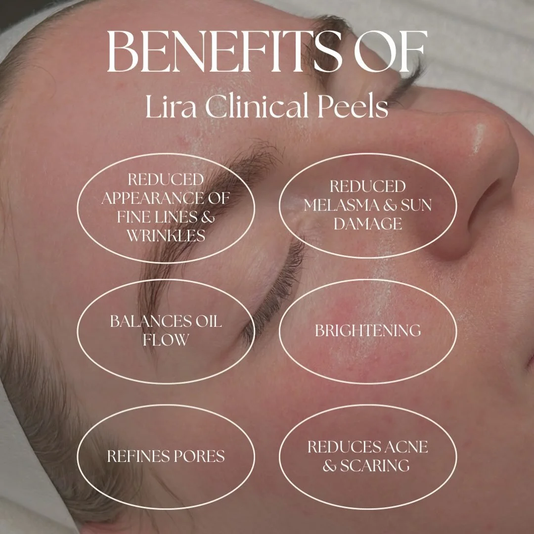 Whether your concern is pigmentation, fine lines, breakouts or dullness. Our Lira clinical advanced formulas work beneath the surface to restore true skin health. 

Lira Clinical Peels don&rsquo;t just exfoliate. 

They rebuild, rebalance &amp; repai