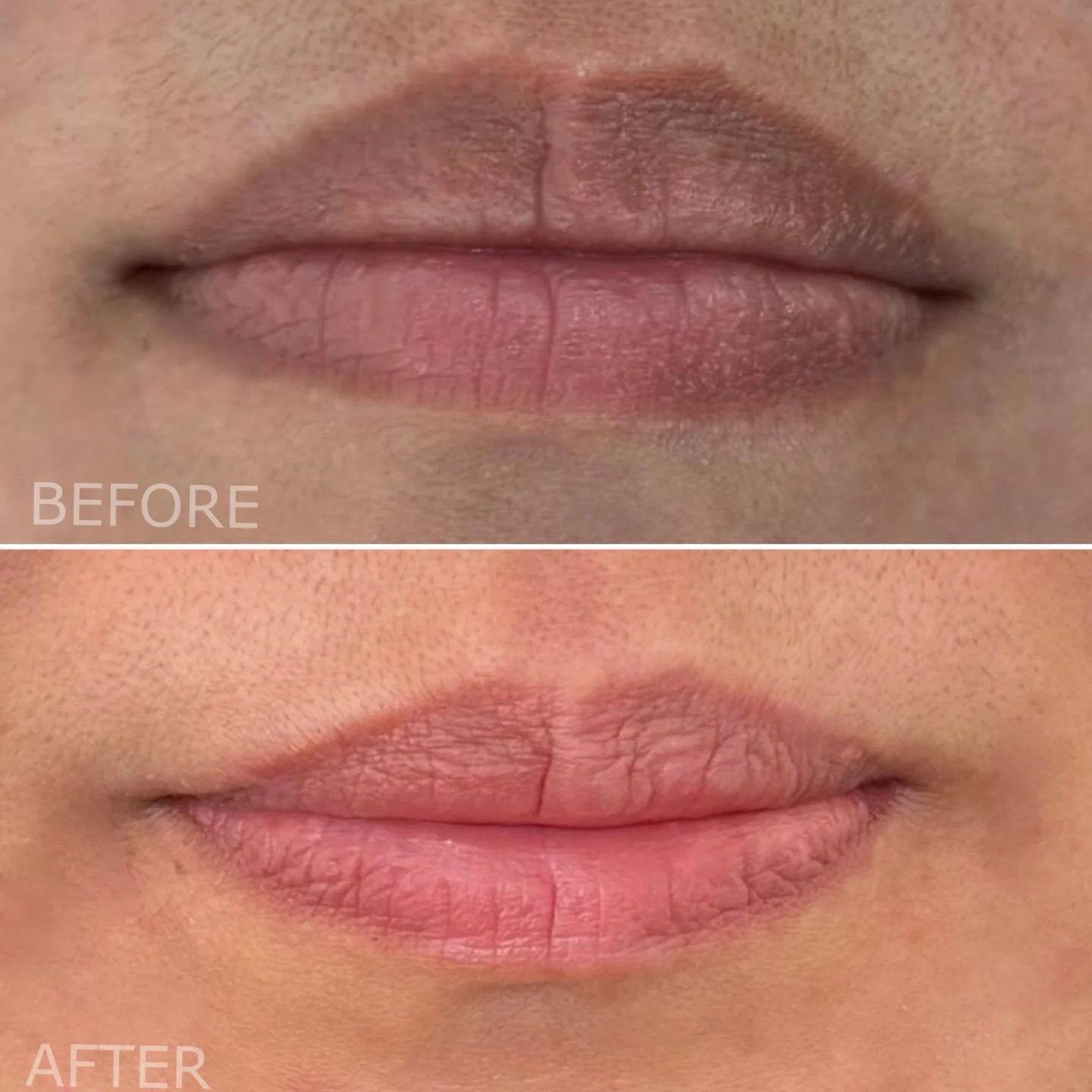 Close-up of lips with dry, chapped skin in the top image labeled 'BEFORE' and the same lips appearing moisturized and smoother in the bottom image labeled 'AFTER'.
